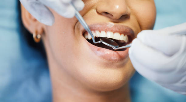Best Emergency Dentist for Knocked-Out Tooth in Washington Park, FL