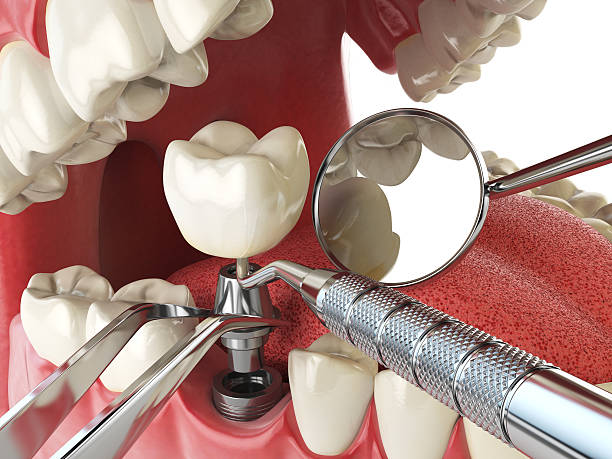 Emergency Dentist for Special Needs Patients